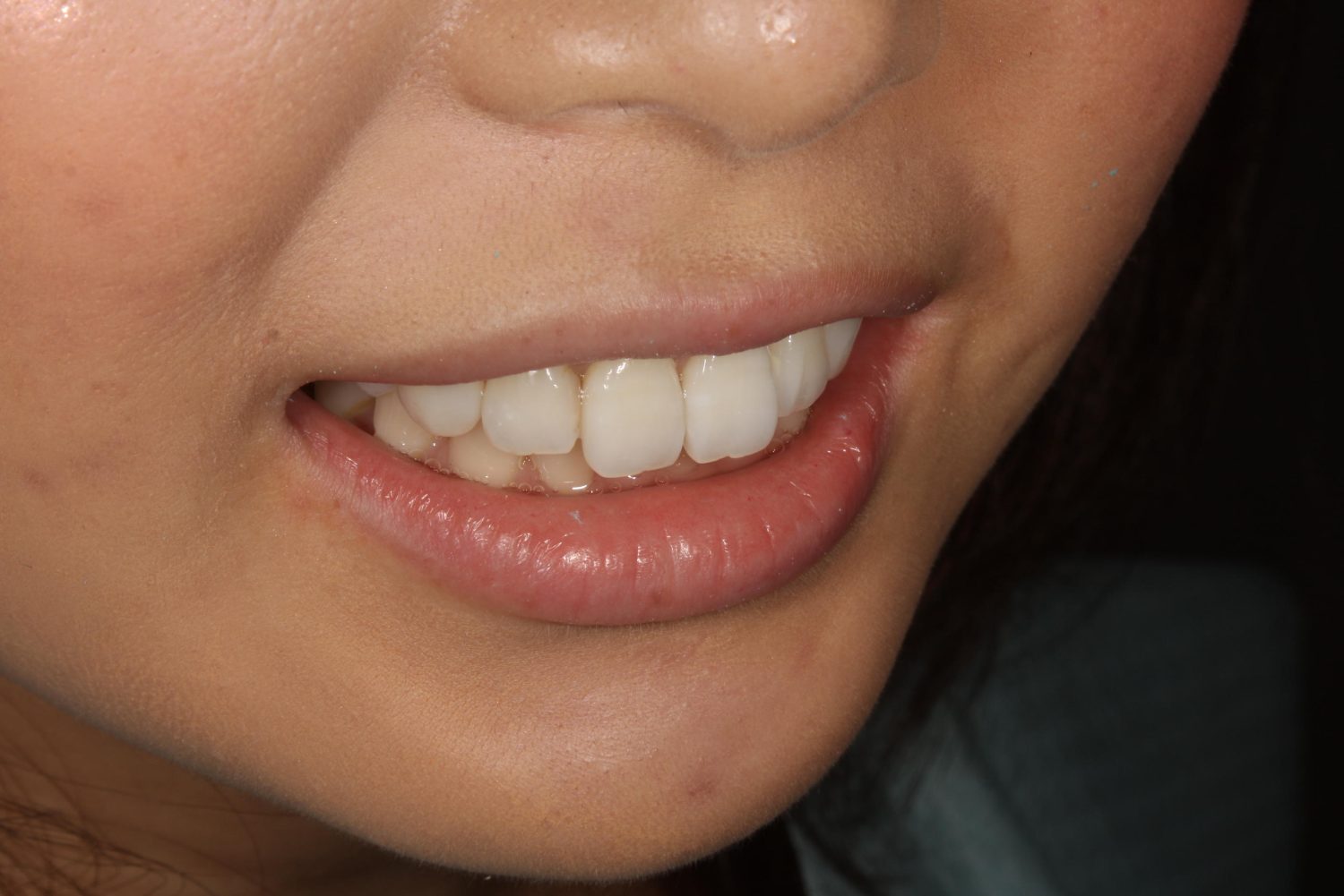 吉田歯科診療室デンタルメンテナンスクリニック