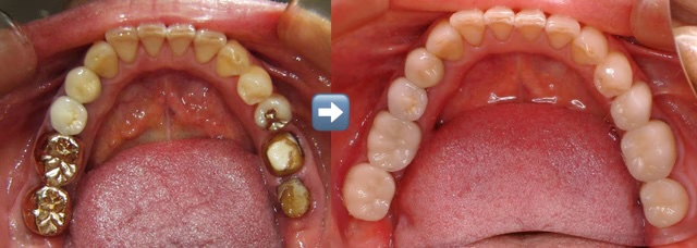 吉田歯科診療室デンタルメンテナンスクリニック