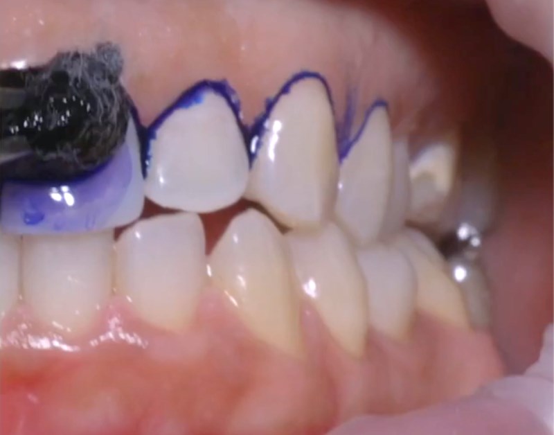 一宮苅安賀歯科こども歯科