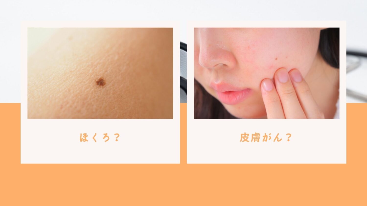 乾癬や皮膚がんを治療せずに放置するとどうなりますか?