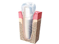 桜町歯科クリニック詳細写真2