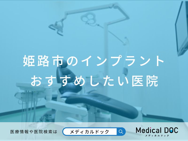 おすすめしたいインプラント歯科医院