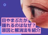 まぶたが腫れるのはアイシャドウが悪い？ 目が腫れる原因と解消法を解説