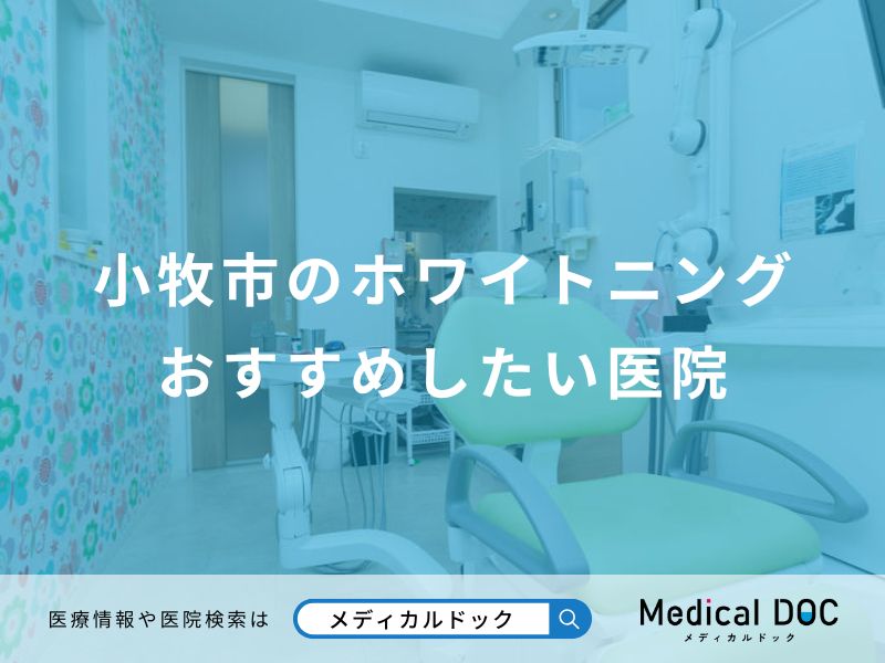 小牧市のホワイトニングおすすめしたい医院