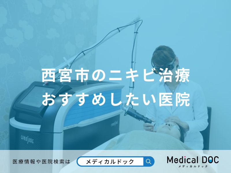 西宮市のニキビ治療おすすめしたい医院
