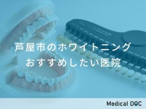 芦屋市のホワイトニングおすすめしたい医院