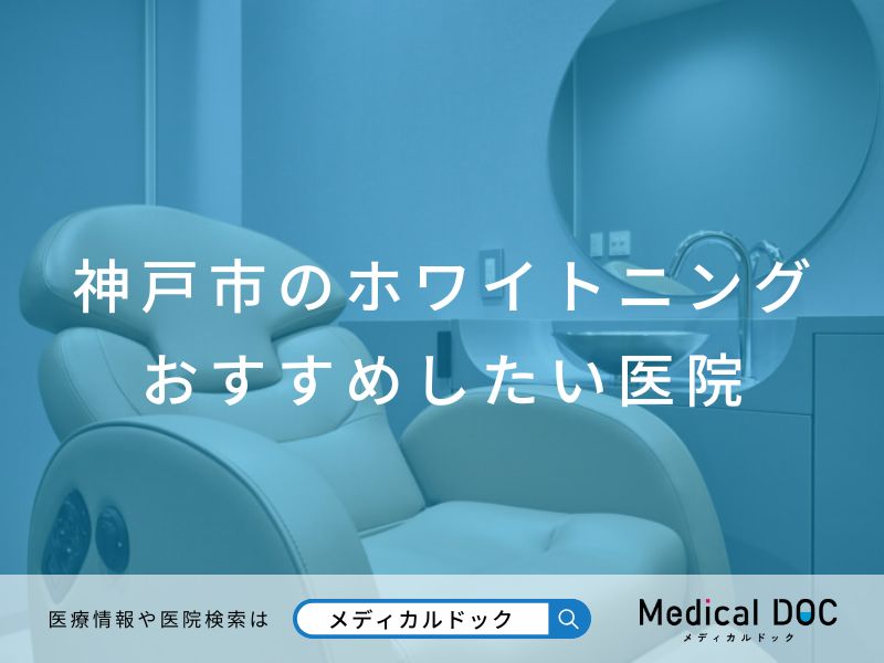 神戸市のホワイトニング おすすめしたい医院