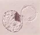 【日本産科婦人科学会が発表】不妊治療の着床前検査、条件付きで容認へ