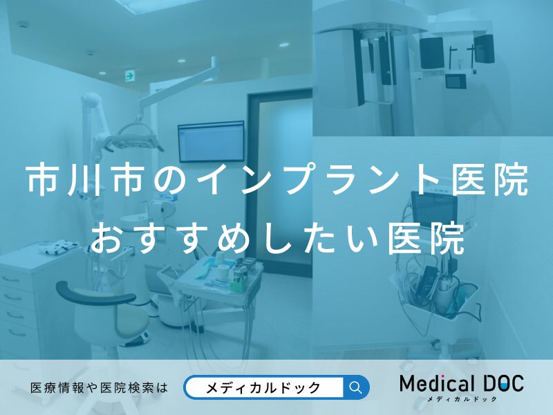 市川市のインプラント医院 おすすめしたい医院
