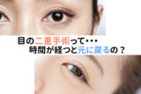 目の二重手術って時間が経つと元に戻るの？