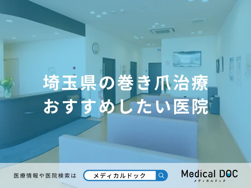 埼玉県の巻き爪