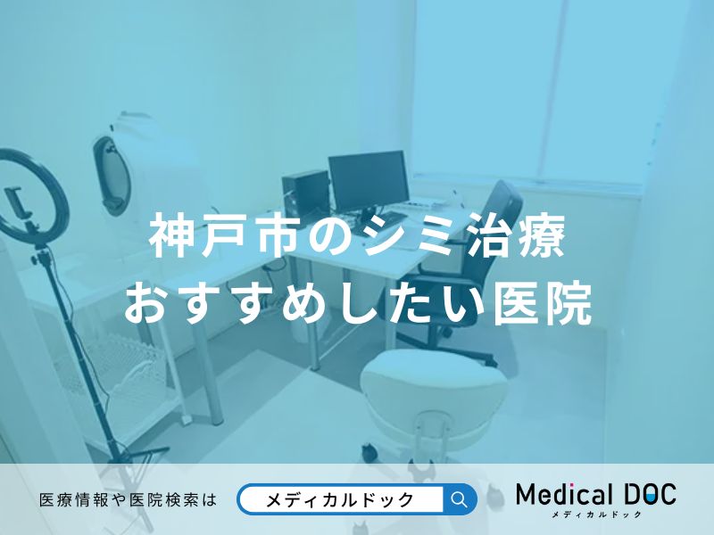 神戸市のシミ治療