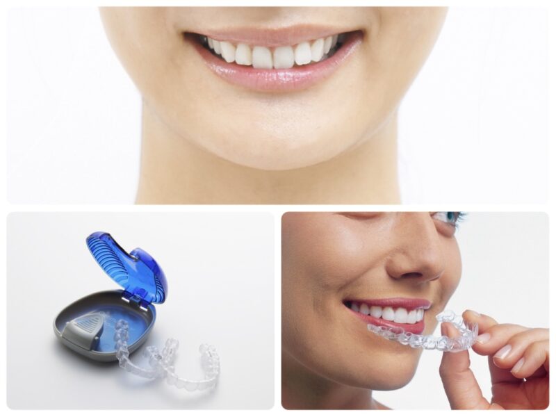 すずき歯科五反田Gタワークリニックphoto