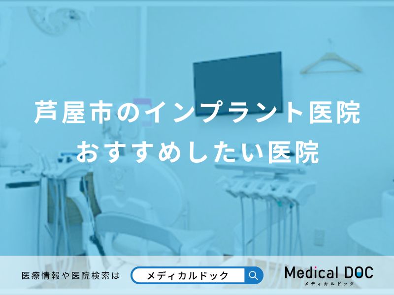 芦屋市のインプラント医院 おすすめしたい医院