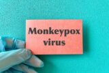 サル痘発生に備えて医療従事者への天然痘ワクチン接種を検討