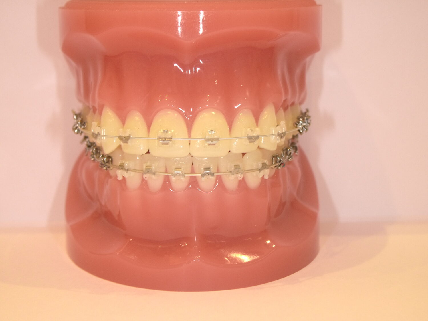 おばら矯正歯科詳細写真3