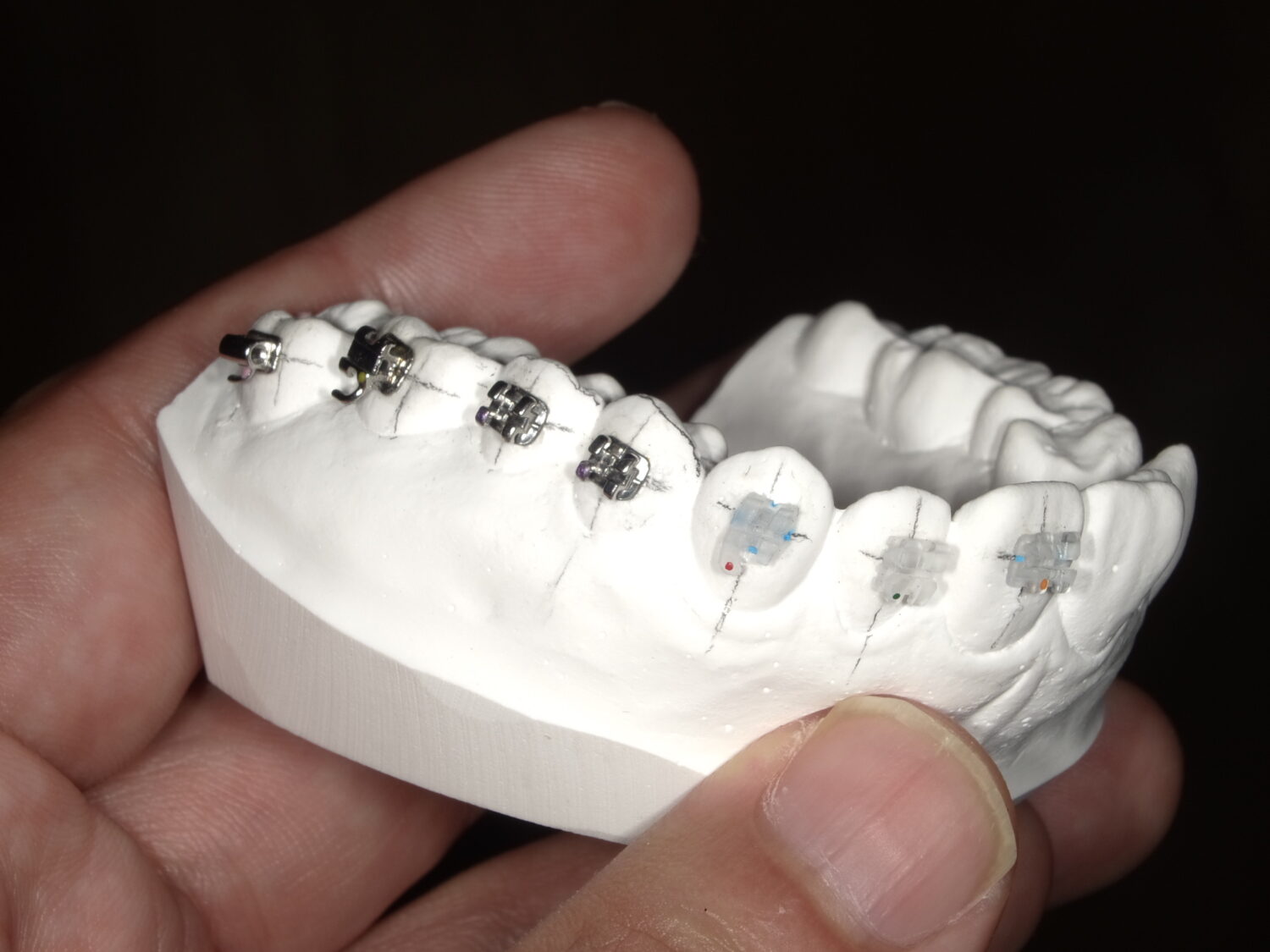 おばら矯正歯科詳細写真2