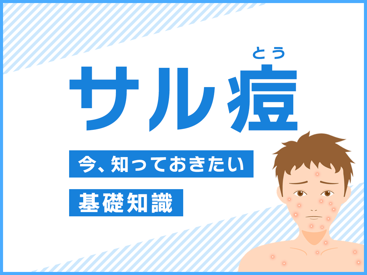 サル痘～今、知っておきたい基礎知識～