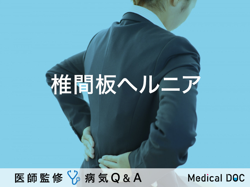 関節炎とは何ですか?