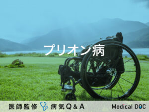 「プリオン病」とは？症状・原因・治療法も併せて解説！【医師監修】
