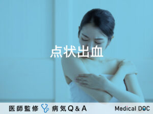 「点状出血（皮膚に赤や紫の点）」ができる原因はご存知ですか？【医師監修】
