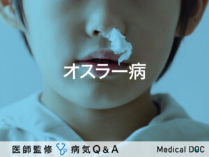 「オスラー病」とは？症状・原因・何科を受診するべきか解説！【医師監修】