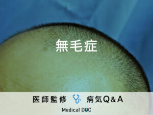 「無毛症」を発症する原因はご存知ですか？医師が監修！
