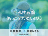 「毛孔性苔癬（もうこうせいたいせん）」とは？治療・原因も解説！【医師監修】
