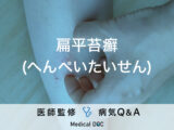 「扁平苔癬（へんぺいたいせん）」とは？原因・がん・治療法も解説！