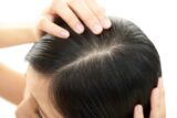 「女性の薄毛治療」方法はご存知ですか？原因についても詳しく解説！