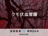 「クモ状血管腫」を発症すると「赤い発疹」ができるの？医師が監修！