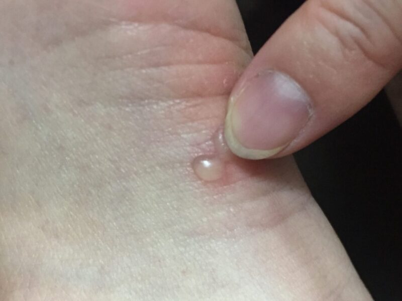 皮膚病変はどのように診断されますか?