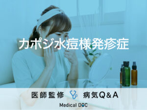 「カポジ水痘様発疹症」を医師が解説！家族内感染や再発に要注意！
