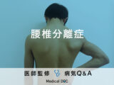 「腰椎分離症」は放置すると危険？医師が徹底解説！