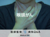 「喉頭がん」の自覚症状・原因はご存知ですか？医師が監修！