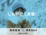 「しもやけ（凍瘡）」が重症化するとどうなるかご存知ですか？対処法も解説！