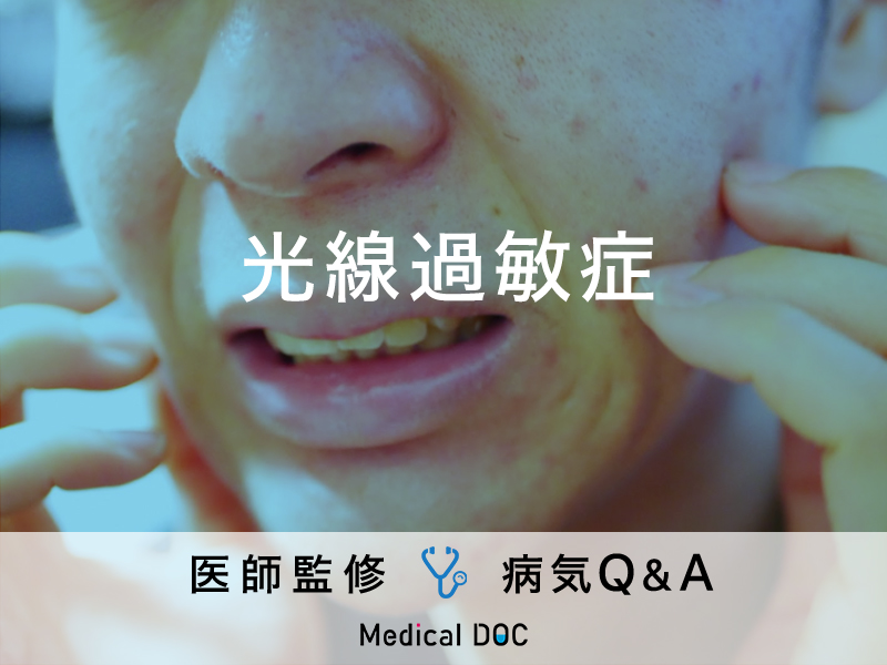 自宅でできる食物アレルギー検査