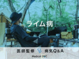 【医師解説】EXILE・ATSUSHIが発症した｢ライム病｣の症状･感染経路とは?