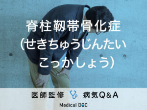 背筋や首の違和感には要注意！「脊柱靱帯骨化症」を医師が徹底解説！