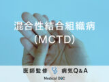 「混合性結合組織病（MCTD）」とは？症状や原因について医師が解説！