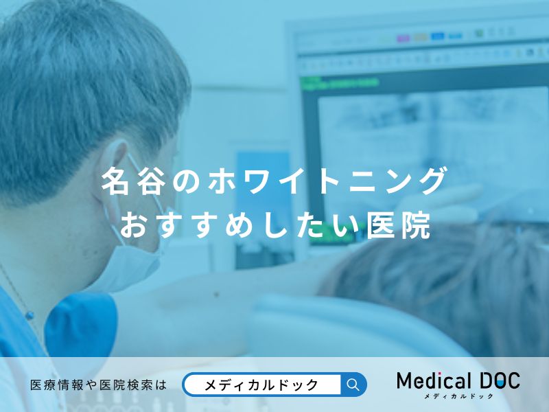 名谷のホワイトニング おすすめしたい医院