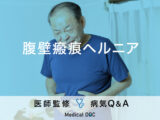 「腹壁瘢痕ヘルニア」の症状・原因・発症しやすい人の特徴はご存知ですか？