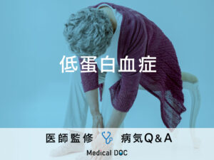 「低蛋白血症」を医師が解説！身体のむくみや倦怠感はありませんか？