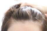 「女性の薄毛は改善」できる？薬や原因についても詳しく解説！