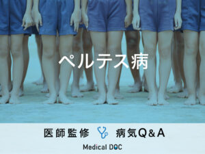 「ペルテス病」を発症すると現れる症状・原因はご存知ですか？医師が監修！