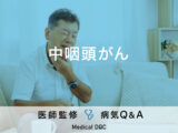 「中咽頭がん」を発症すると現れる症状・原因はご存知ですか？医師が監修！