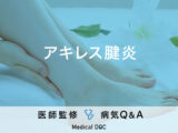 「アキレス腱炎」は知らない間に発症？原因やなりやすい人など医師が監修！