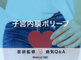 「子宮内膜ポリープ」を疑う初期症状・原因はご存知ですか？医師が監修！