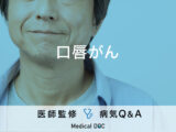 「口唇がん」を発症すると現れる症状・原因はご存知ですか？医師が監修！
