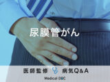 「尿膜管がん」を発症すると現れる症状・原因はご存知ですか？医師が監修！